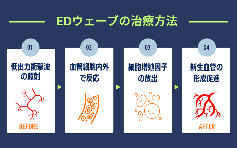 EDウェーブ　治療方法